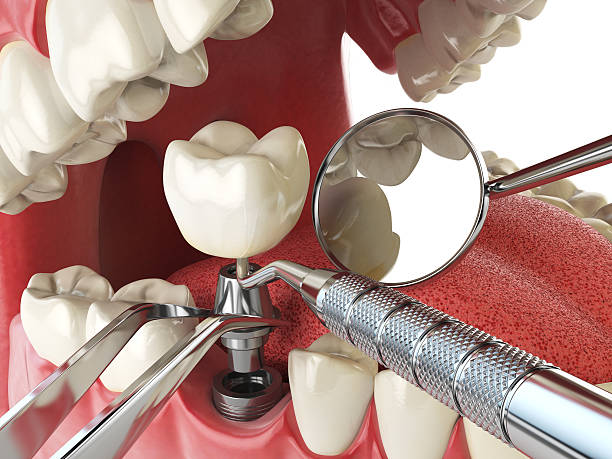 Best Emergency Denture Repair in Westville, NJ